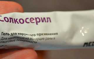 Солкосерил при солнечных ожогах отзывы