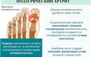 Сан кур лечение при подагре