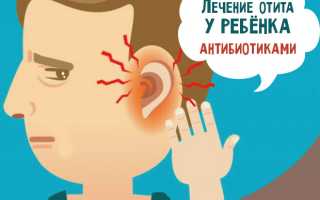Отит у ребенка когда давать антибиотики