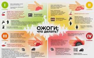 Ожоги при термические химические электрические