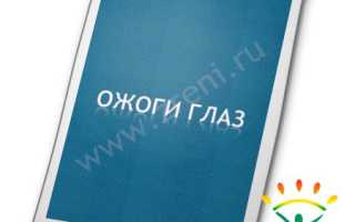 Мкб 10 ожог слизистой глаза