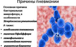 Как наступает смерть от пневмонии