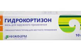 Когда можно мыться после отита