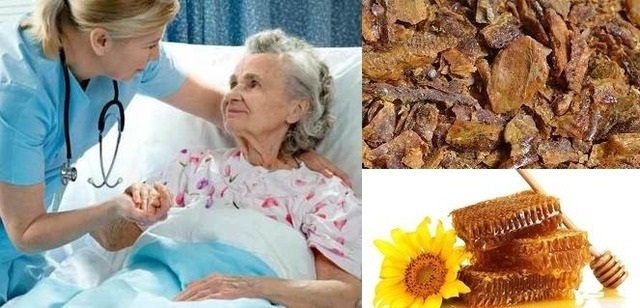 Настойка на прополисе от пролежней