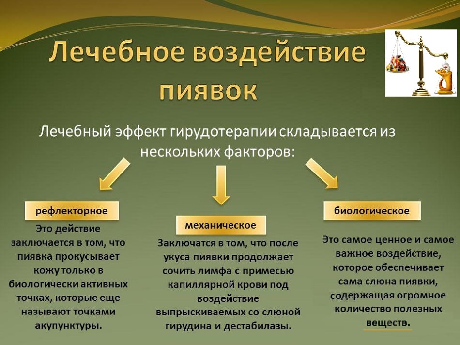 Куда ставят пиявки при подагре