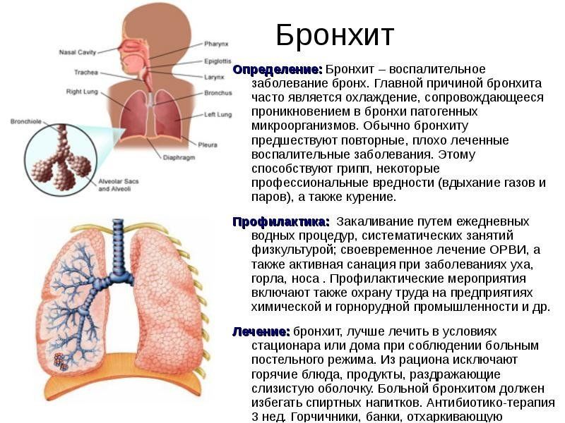 Микоплазма пневмонии может развиться на фоне бронхита 
