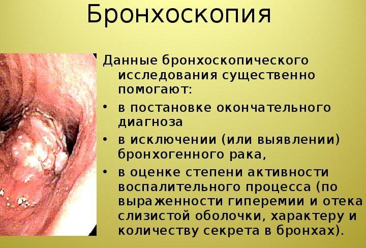 Какие анализы могут выявить пневмонию thumbnail