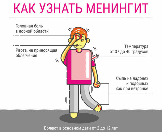 Осложнением пневмонии является менингит