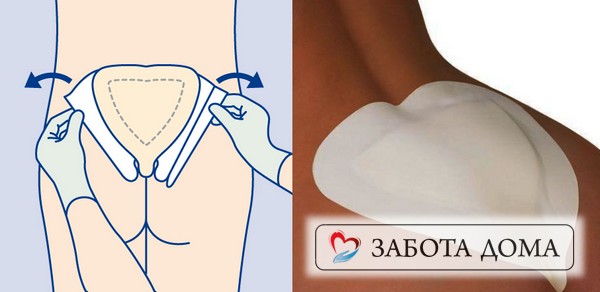Повзка бабочка