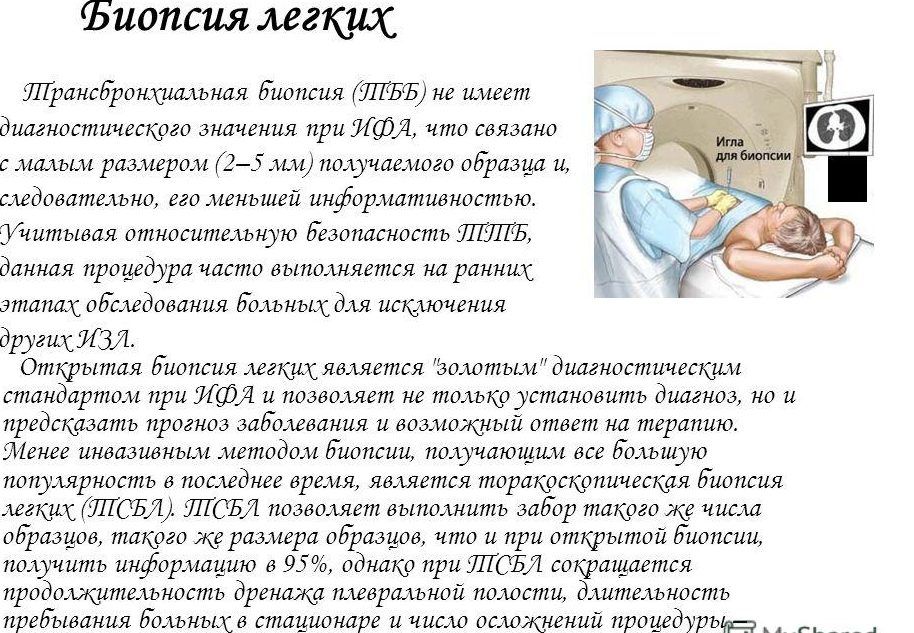 Биопсия легочной ткани для диагностики пневмонии