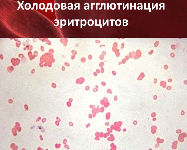 Холодовые агглютинины