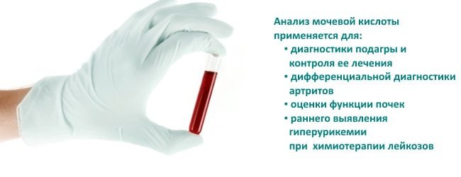 Как убрать подагру на ногах
