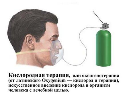 Оксигенотерапия