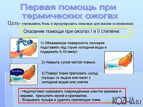 первая помощь при термическом ожоге