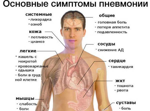 Симптомы воспаления легких
