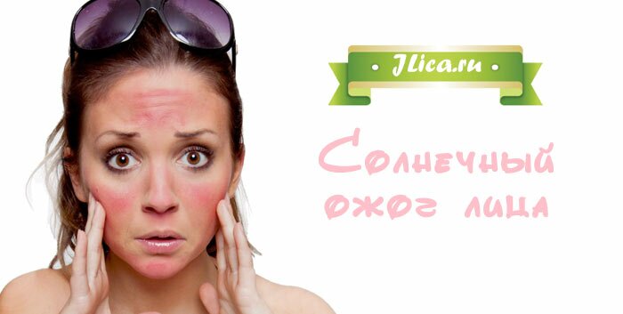 солнечный ожог лица